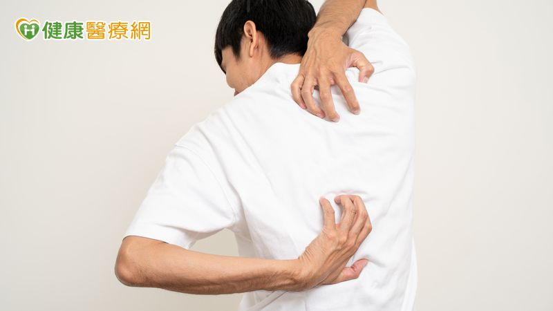 藥物不良反應為何常見於皮膚？醫詳解原因！6警訊辨識嚴重症狀 | yam News